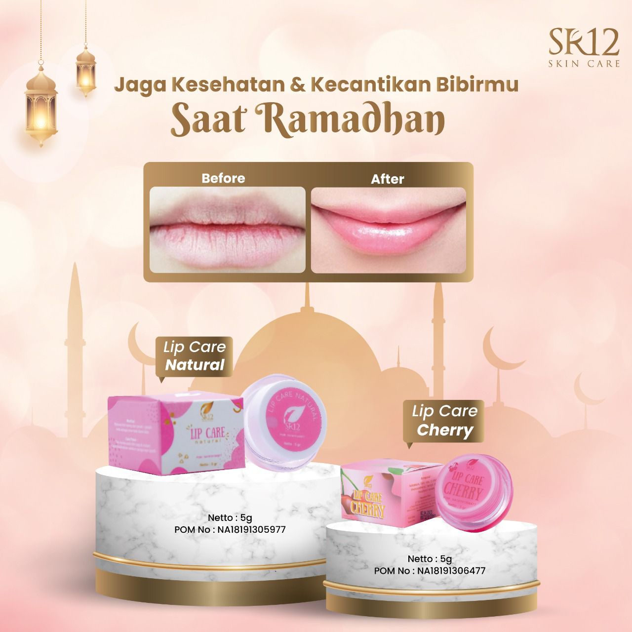 Perawatan Bibir SR12 Saat Puasa - Hasil Sebelum dan Sesudah